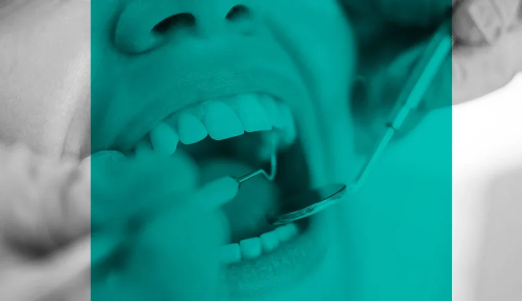 Parodontitisbehandlung bei Ihrem Zahnarzt in Brauweiler
